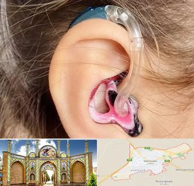 ساخت قالب سمعک در سمنان