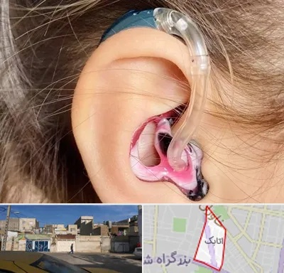 ساخت قالب سمعک در اتابک