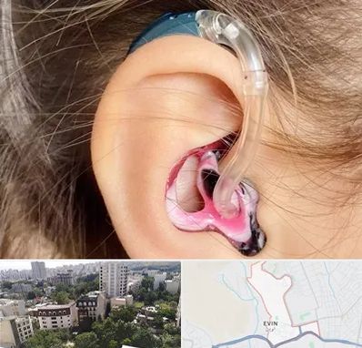 ساخت قالب سمعک در اوین