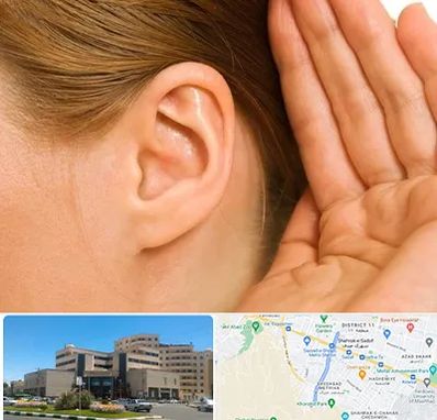 درمان وزوز گوش در صیاد شیرازی مشهد 