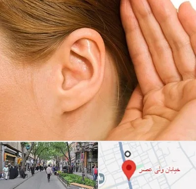 درمان وزوز گوش در ولیعصر شهریار