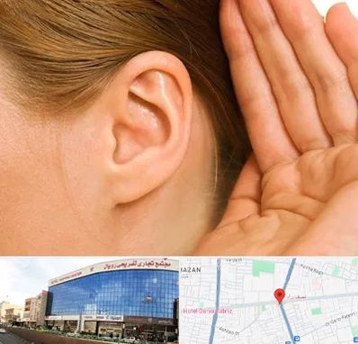 درمان وزوز گوش در نصف راه تبریز