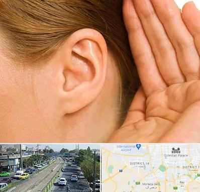 درمان وزوز گوش در جنوب تهران 