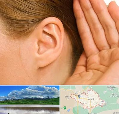 درمان وزوز گوش در مرند