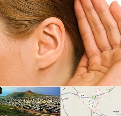 درمان وزوز گوش در بیجار