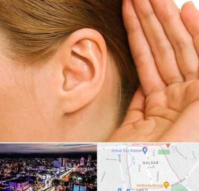 درمان وزوز گوش در گلسار رشت 