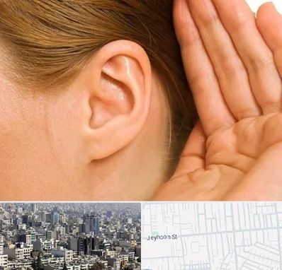 درمان وزوز گوش در جیحون
