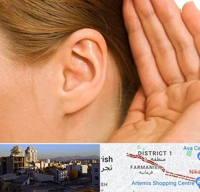 درمان وزوز گوش در فرمانیه 
