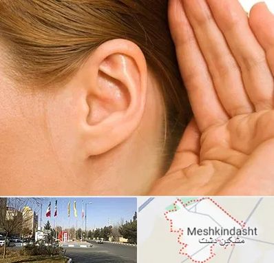 درمان وزوز گوش در مشکین دشت