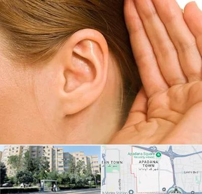درمان وزوز گوش در آپادانا