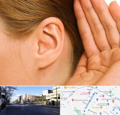 درمان وزوز گوش در خیابان ملاصدرا شیراز 