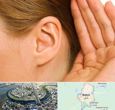 درمان وزوز گوش در بابل