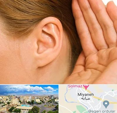 درمان وزوز گوش در میانه