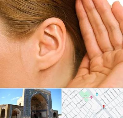 درمان وزوز گوش در مصلی مشهد