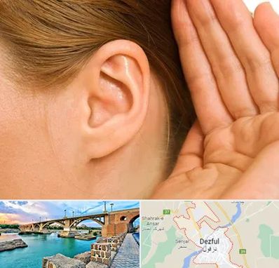 درمان وزوز گوش در دزفول