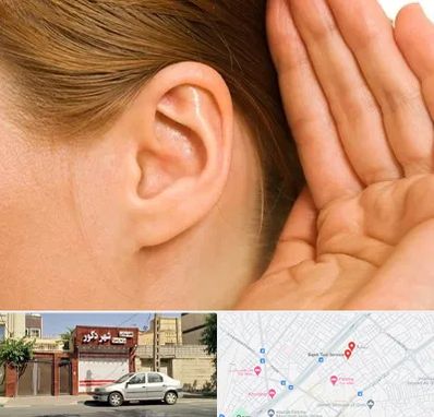 درمان وزوز گوش در باجک قم