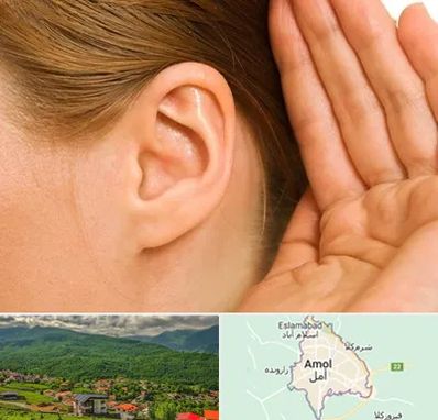 درمان وزوز گوش در آمل