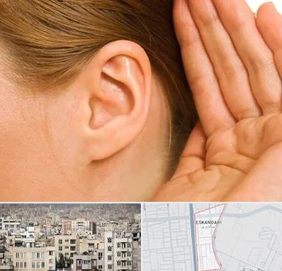 درمان وزوز گوش در اسکندری