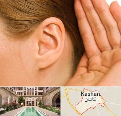 درمان وزوز گوش در کاشان