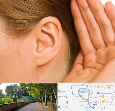 درمان وزوز گوش در فلکه گاز رشت 