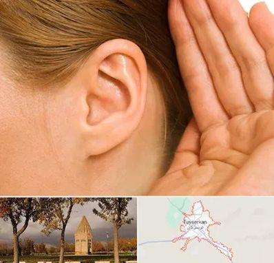 درمان وزوز گوش در تویسرکان