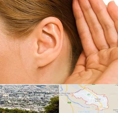 درمان وزوز گوش در یاسوج