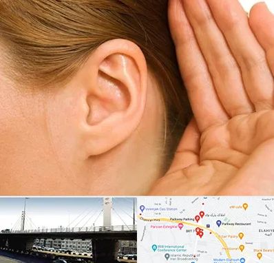 درمان وزوز گوش در پارک وی 