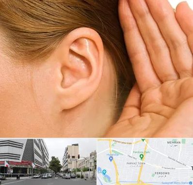 درمان وزوز گوش در بلوار فردوس 