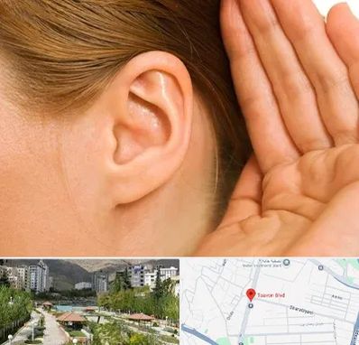 درمان وزوز گوش در بلوار تعاون