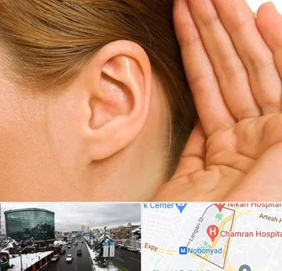 درمان وزوز گوش در اقدسیه 