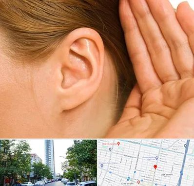 درمان وزوز گوش در امامت مشهد 