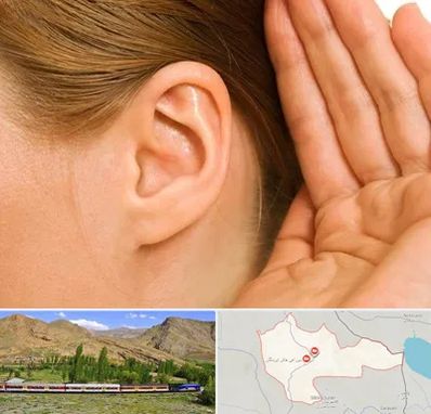 درمان وزوز گوش در خاش