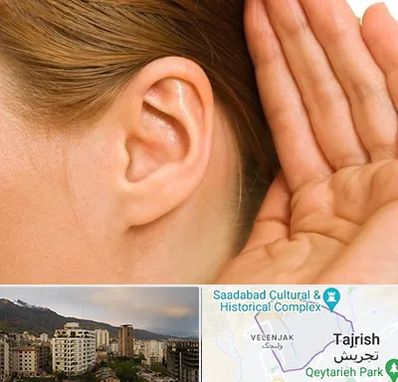 درمان وزوز گوش در زعفرانیه 