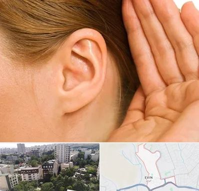 درمان وزوز گوش در اوین