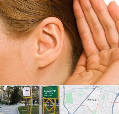 درمان وزوز گوش در تهران ویلا