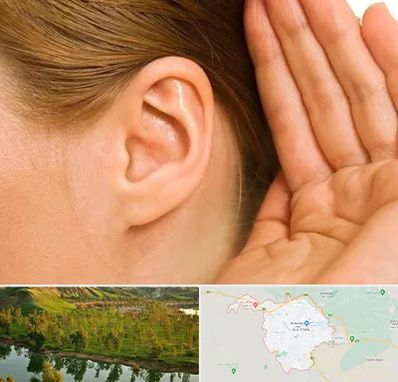 درمان وزوز گوش در بهبهان