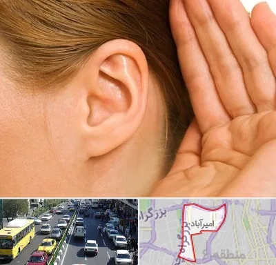 درمان وزوز گوش در امیرآباد