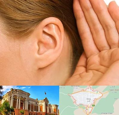 درمان وزوز گوش در خوی