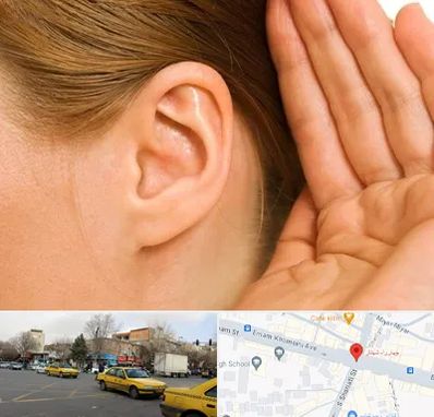 درمان وزوز گوش در شهناز تبریز