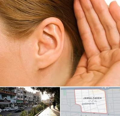 درمان وزوز گوش در خیابان جمالزاده