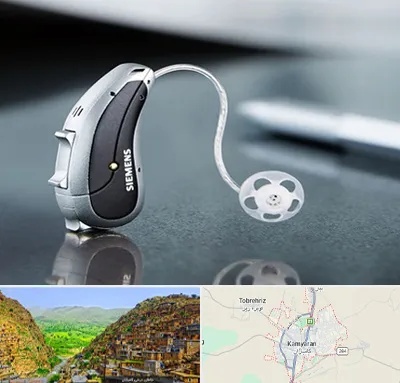 نمایندگی سمعک زیمنس در کامیاران