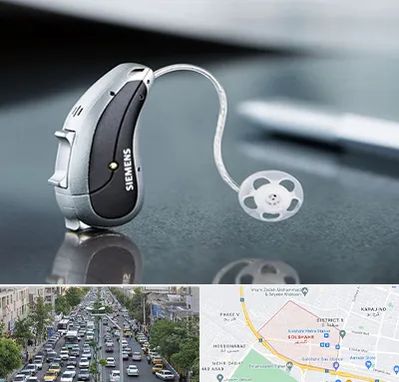 نمایندگی سمعک زیمنس در گلشهر کرج 