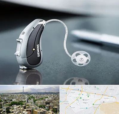 نمایندگی سمعک زیمنس در منطقه 8 تهران 