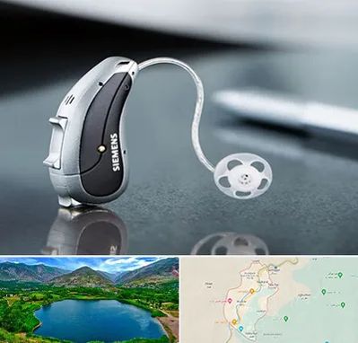 نمایندگی سمعک زیمنس در رودبار