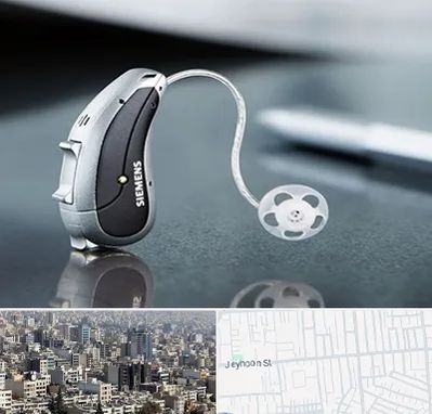 نمایندگی سمعک زیمنس در جیحون