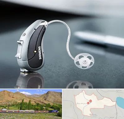 نمایندگی سمعک زیمنس در خاش