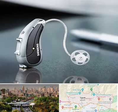 نمایندگی سمعک زیمنس در منطقه 1 تهران 