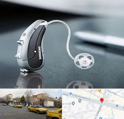 نمایندگی سمعک زیمنس در شهناز تبریز