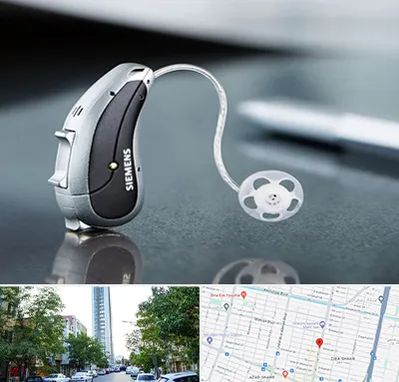 نمایندگی سمعک زیمنس در امامت مشهد 