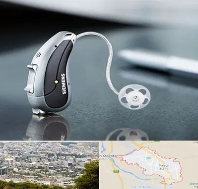 نمایندگی سمعک زیمنس در یاسوج